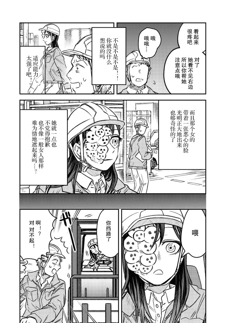 面疮和青春痘的区别漫画,第8话2图